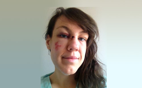 Woman Beaten After Being Groped Posts #nomakeupselfie To Fight Back