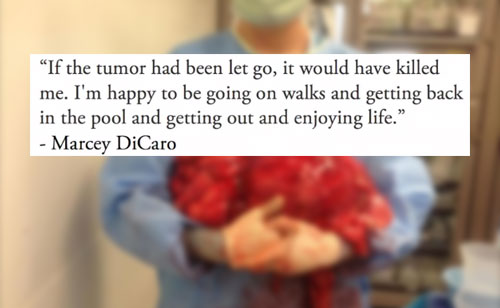 47-pound Tumor Removed From Arizona Woman Thanks To Obamacare (VIDEO)